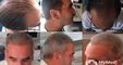 Clinicana Hair Transplant and Esthetic Center