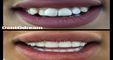 DentOdream / Dental Dream Turkey