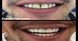 DentOdream / Dental Dream Turkey