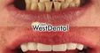 WestDent Clinic Turkey