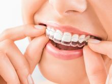Search and Compare the Best Clinics and Doctors at the Lowest Prices for Invisalign in Turkey