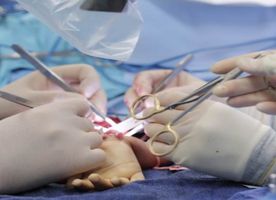 Hand Surgery