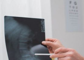 Artificial Disc Replacement