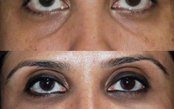 Compare Reviews, Prices & Costs of Plastic and Cosmetic Surgery in South Africa at The Face and Body Place | M-SA2-6