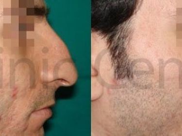 Clinic Center Plastic Surgery London