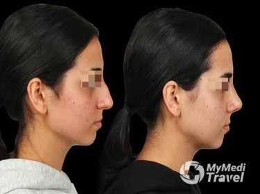 The Nose Aesthetic Clinic - Dr. Cem Altindag