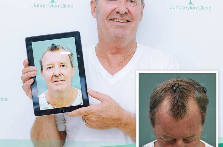 Jungceylon Plastic Surgery Phuket