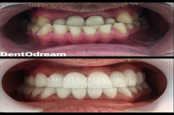 DentOdream / Dental Dream Turkey