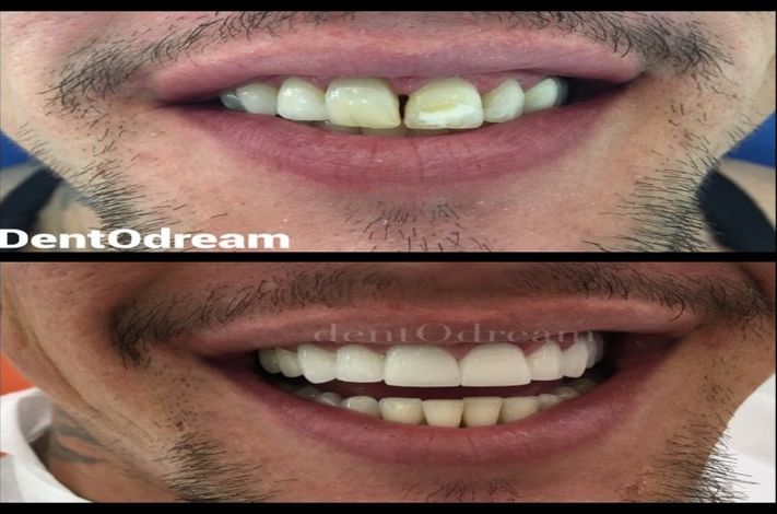 DentOdream / Dental Dream Turkey