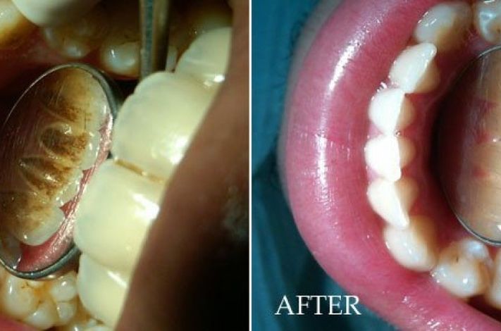 Dr.Aboul Azayem for prothodontics and implant