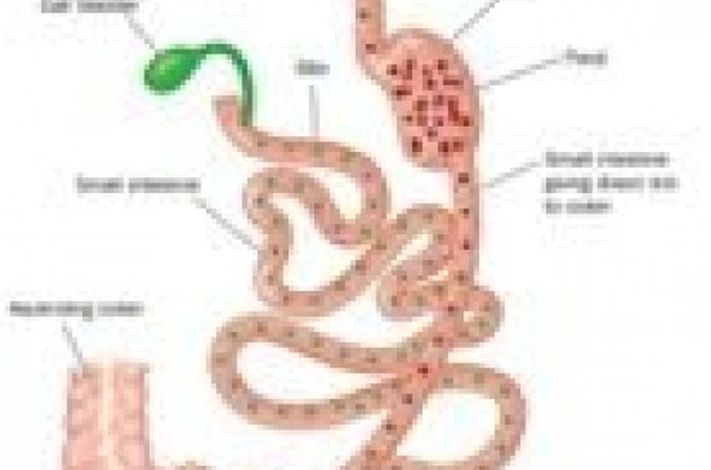 Obesity Bariatric Solutions