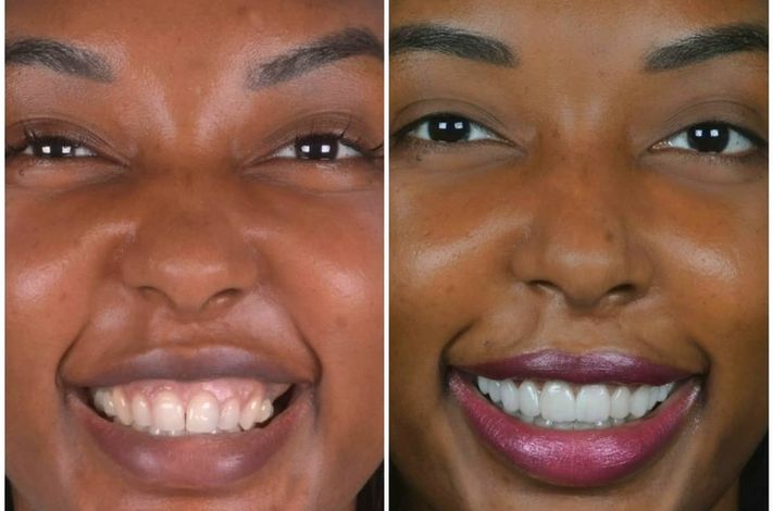 Odontoliuzzi Brazilian Dental Clinic with Excellence