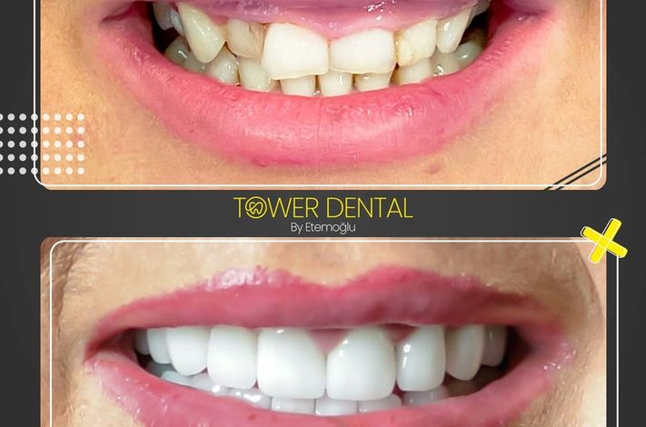 Tower Dental Clinic