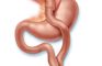 Andrea Bariatric Surgery