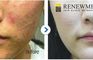 Renewme Skin Clinic