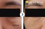 Renewme Skin Clinic
