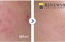 Renewme Skin Clinic Seocho