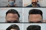 Anastasakis Hair Clinic